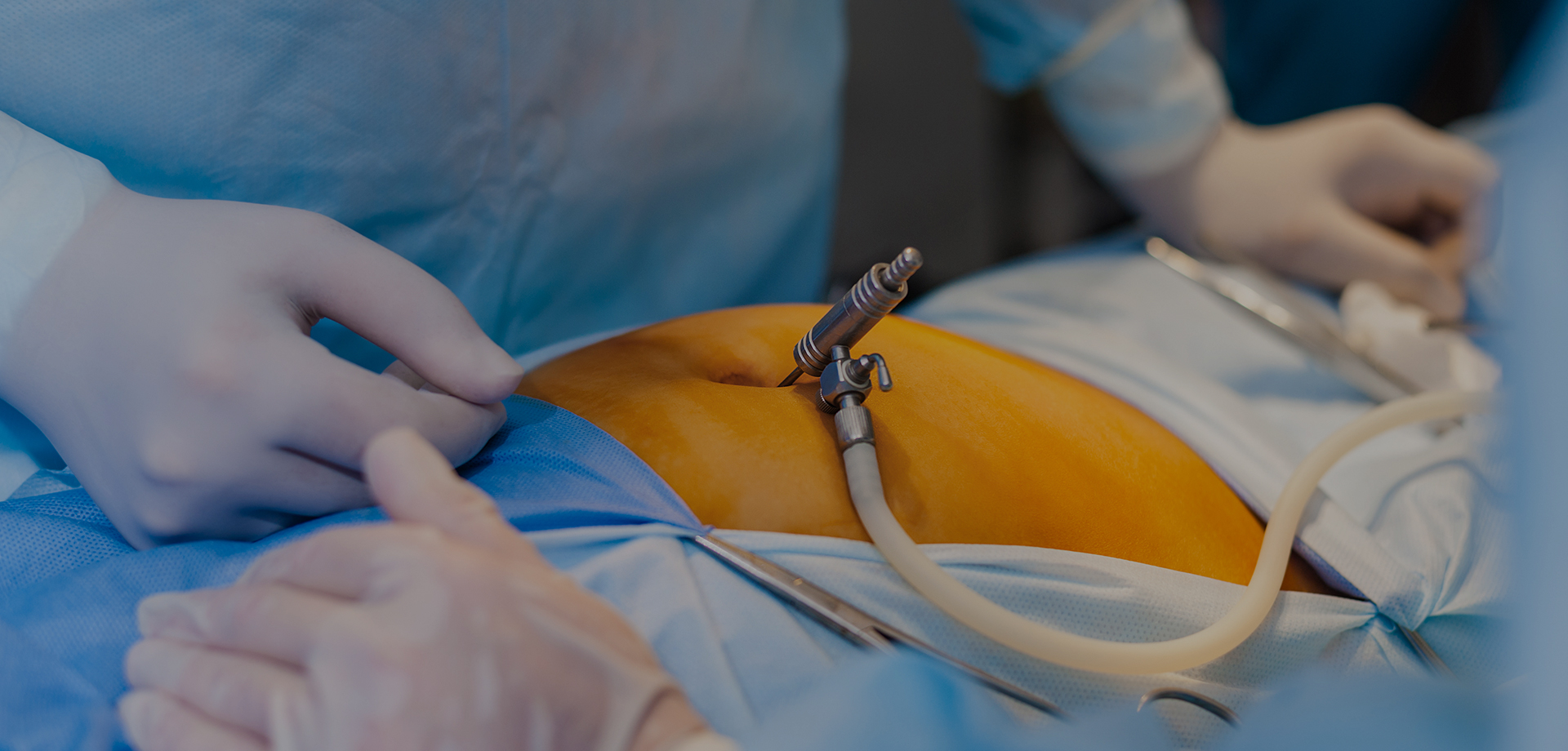 泌尿科/妇科低温等离子手术系统